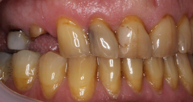 Unconventional applications of dental 3D printing