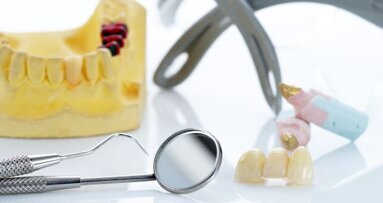 Beroepsorganisaties uiten kritiek op 'stemmingmakerij' NZa