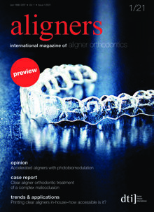 aligners Preview 2021