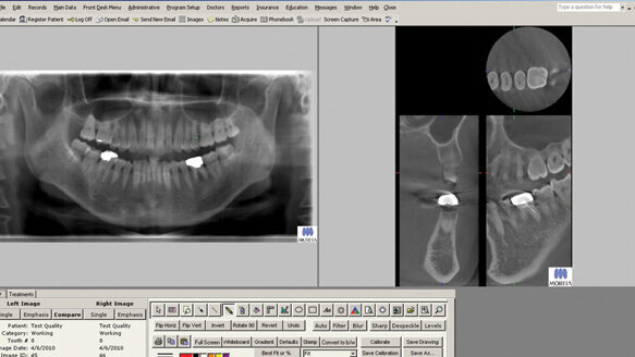 J. Morita USA partners with TDO
