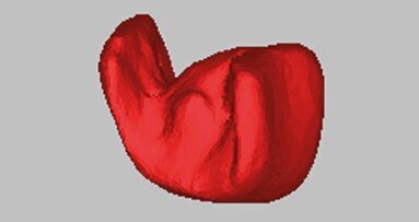 Innesti ossei di idrossiapatite prodotti tramite CAD/CAM in difetti ossei intraorali. Revisione sistematica della letteratura