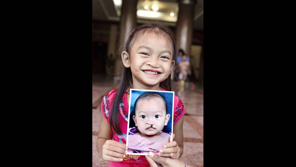 MiSmile founder shares the central role philanthropy plays in the business