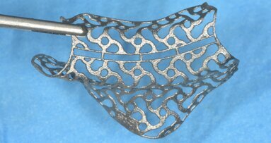 Vertical ridge augmentation using a customised CAD/CAM titanium mesh