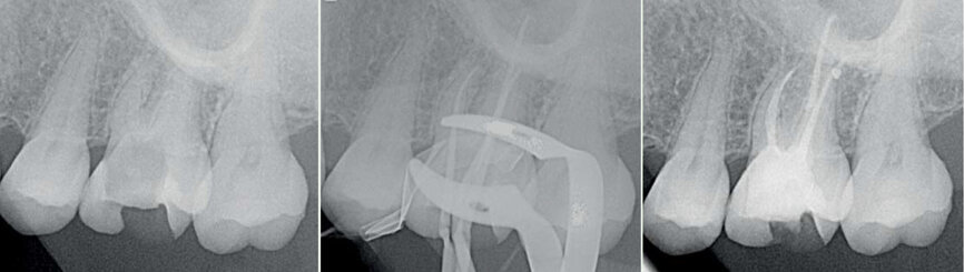 Fig. 8 : Cas clinique Dr Camille Bertrand.