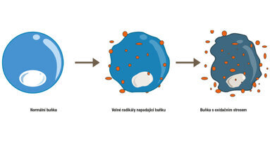 „Souvislost mezi onemocněním dutiny ústní a oxidačním stresem není stále příliš známa“