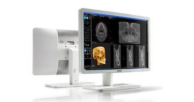 Barco Eonis displays: a clean slate for dental imaging