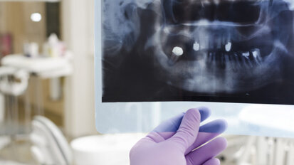 Studie testet Injektion zum Knochenwiederaufbau Studie testet Injektion zum Knochenwiederaufbau