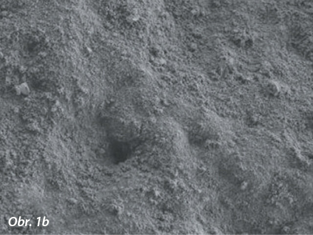 Povrch obnaženého kořenového dentinu (zvětšení 5000×): léčeno zubní pastou INNOVA obsahující hydroxyapatit vápenatý