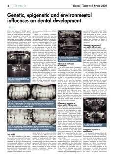 Ortho Tribune U.S.
