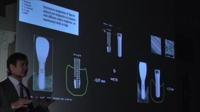 „Kierunki dla implantologii i inżynierii tkankowej” – powierzchnia implantów