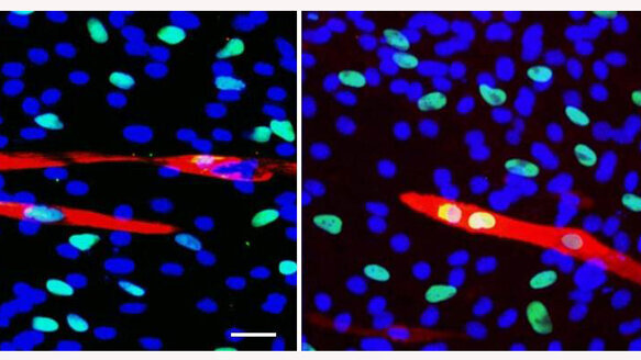 Dentists extract stem cells for future regenerative medicine