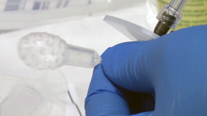 New FDA-approved device will help detect Barrett’s esophagus New FDA-approved device will help detect Barrett’s esophagus