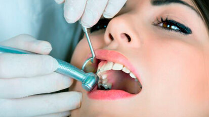 Pocos dentistas usan un dique dental en el tratamiento del conducto radicular Pocos dentistas usan un dique dental en el tratamiento del conducto radicular