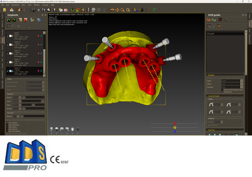 Polorto – DDS-Pro Software