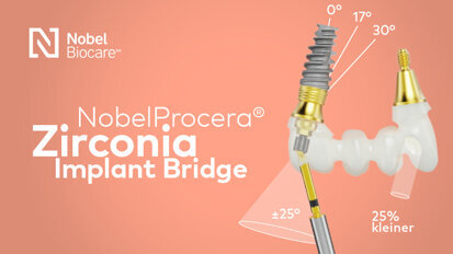 De NobelProcera Zirconia Implant Bridge