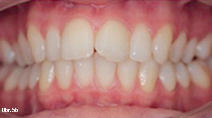 Kazuistika - popis v textu