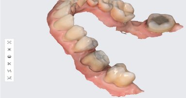 3D tisk ve stomatologii: Tajemství, jak nabídnout více za méně