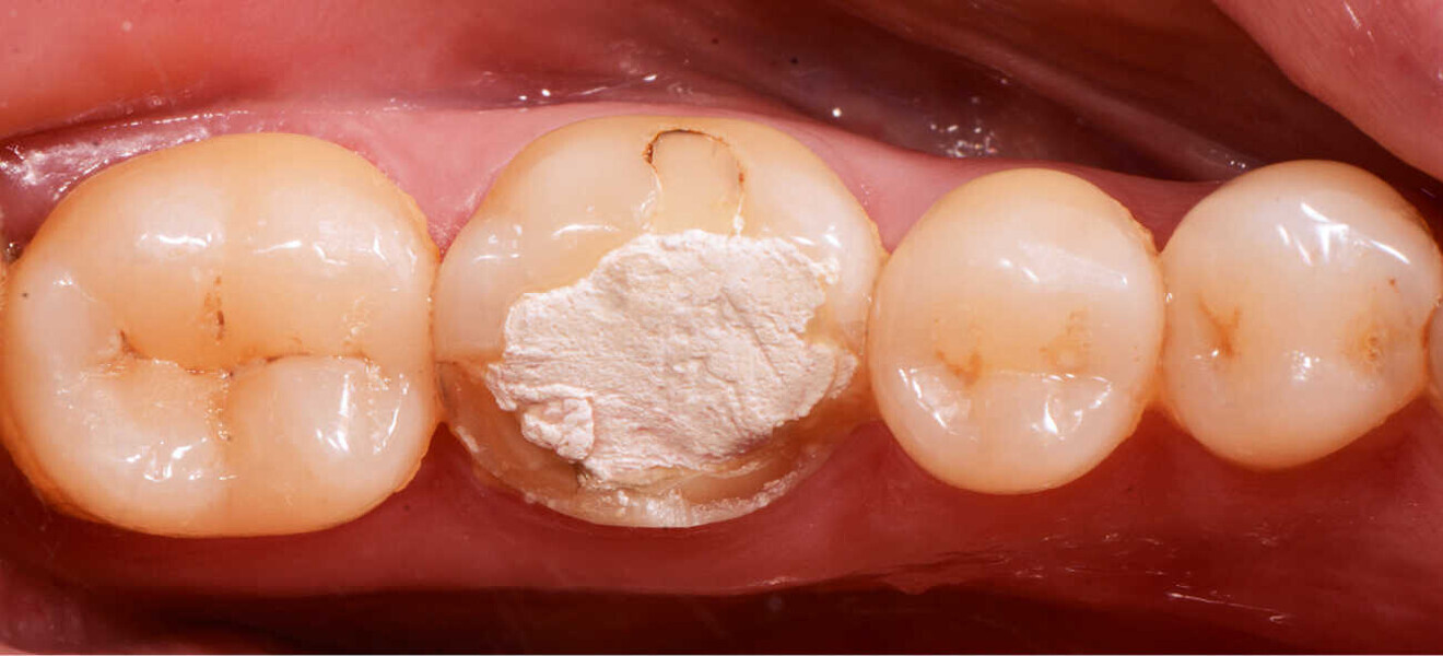 Fig. 1. Situación inicial.