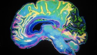 Elektrostymulacja mózgu sposobem na strach przed dentystą?