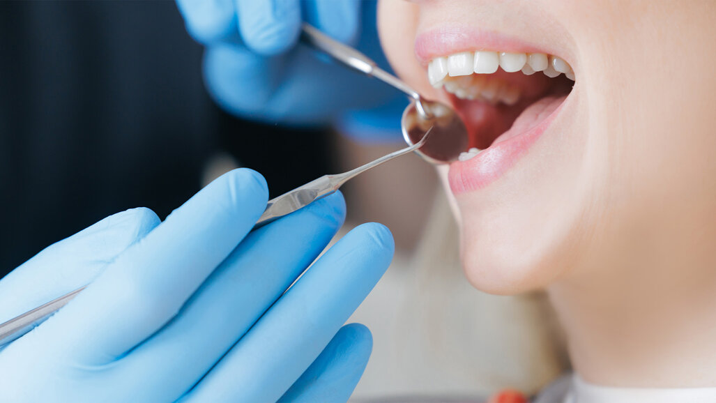 FVDZ fordert zum Weltmundgesundheitstag stärkere Prävention