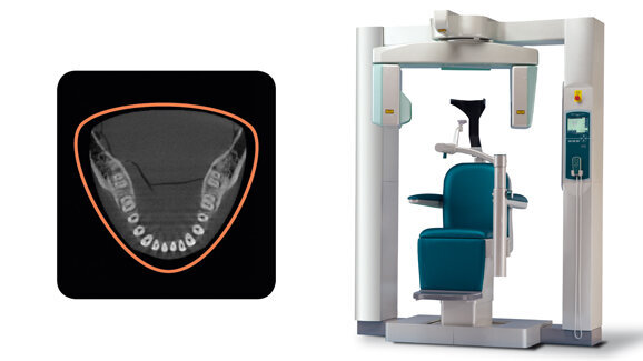 Morita: Innovative Röntgendiagnostik auf DGMKG-Kongress