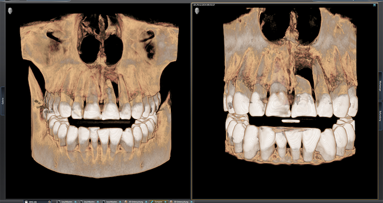 Sidexis 4: More than just imaging software