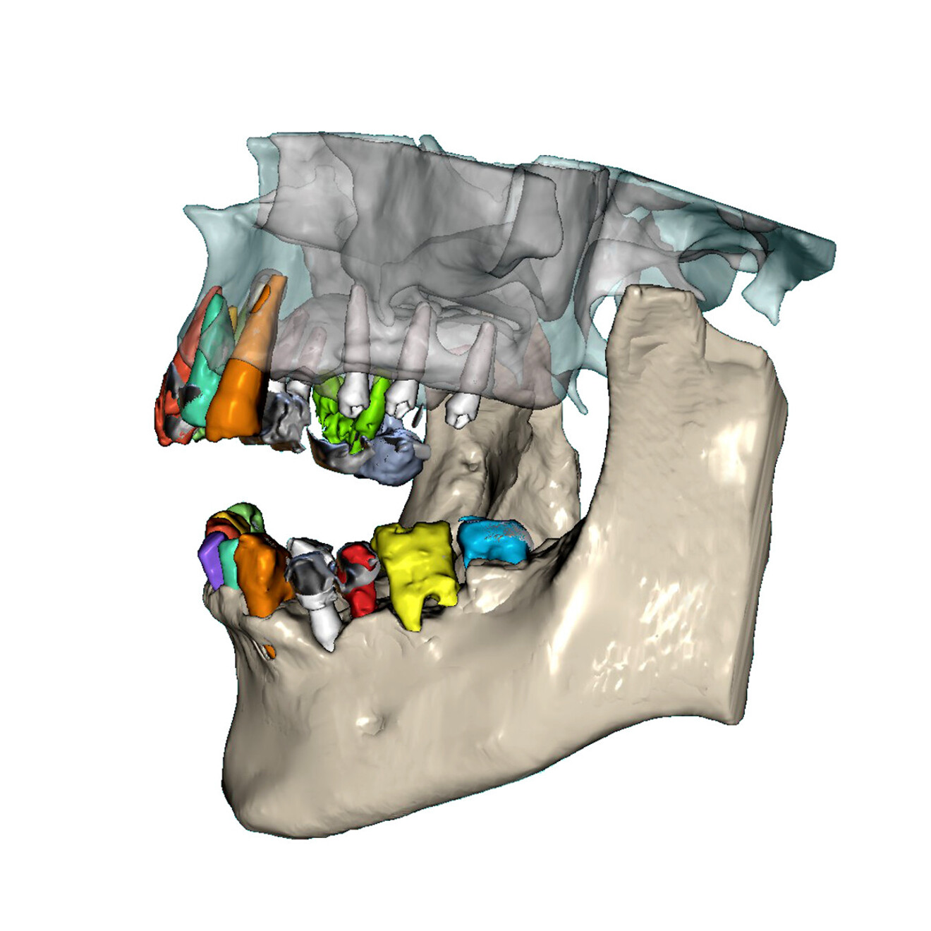 Fig. 5b: Left lateral view.