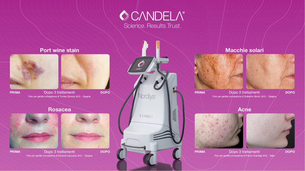 Potenzia il tuo Studio Odontoiatrico con Candela Medical