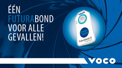 Futurabond U – één 'Bond' voor alle gevallen
