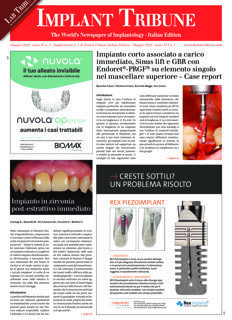 Implant Tribune Italy No.2, 2020