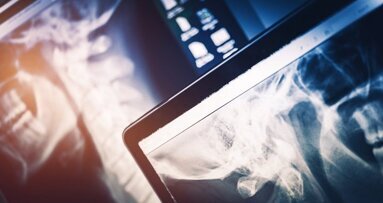 Radiação de raios X é perigosa: autoridades alemãs advertem expositores asiáticos do IDS