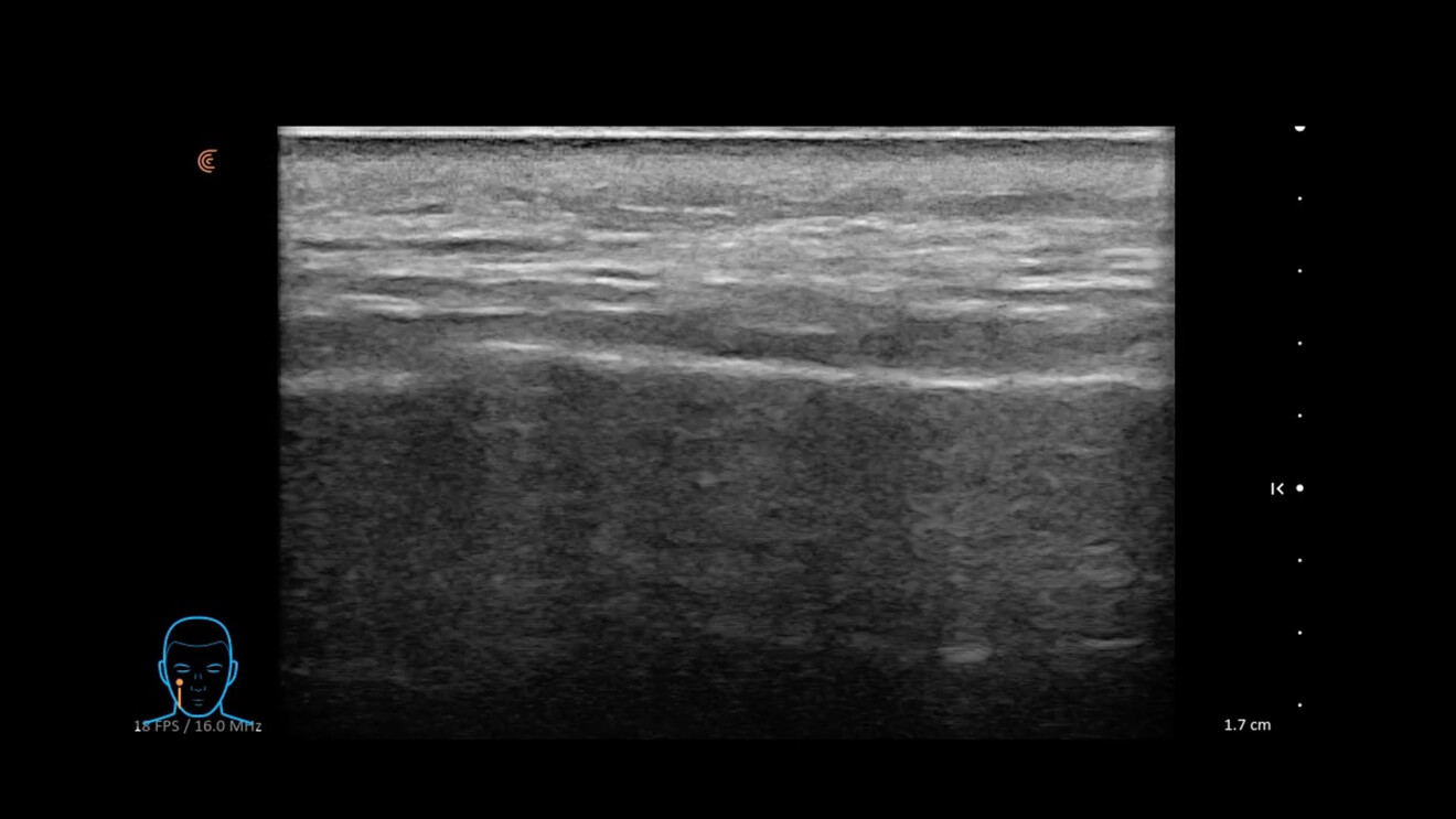 Fig. 6 - Lo spazio prezigomatico.