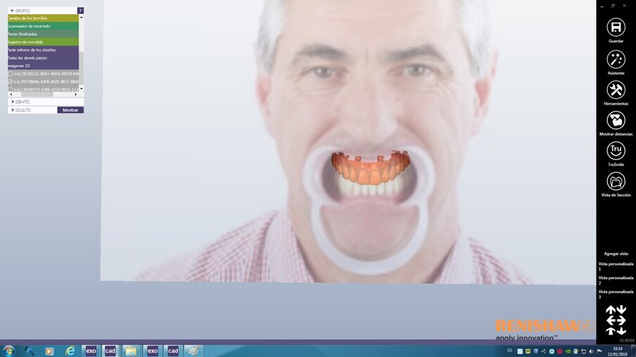 Fig. 1a: Digital mock-up.