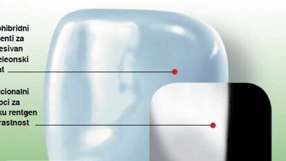 Mali koraci za stomatologa, ali veliki za uspešnu restauraciju