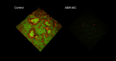 New dental material resists plaque and kills microbes