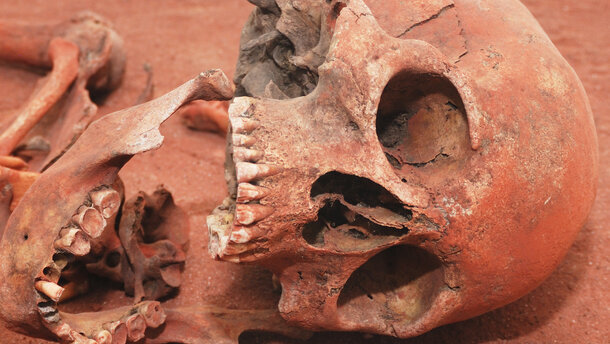 Une flore bactérienne plus riche protégeait nos ancêtres de la carie dentaire