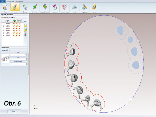 Virtuální umístění korunkových náhrad do disku