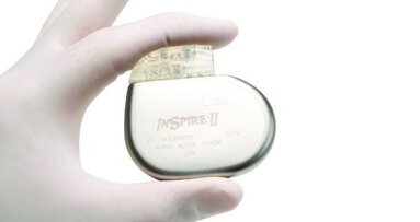 Il nuovo dispositivo impiantabile Inspire potrebbe aiutare i pazienti che soffrono di apnee notturne