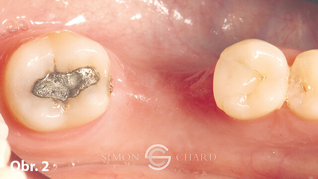 Počáteční situace