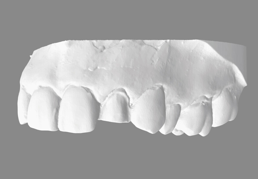 Fig. 7: Virtual patient veneer case.