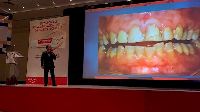 El diseño de sonrisa extremo