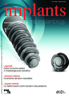 implants Italy No. 1, 2012 implants Italy No. 1, 2012
