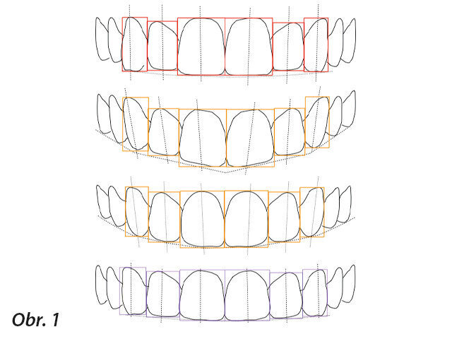 Když zubní lékař poprvé hodnotí nového pacienta s problémy v estetice chrupu, může přehlédnout mnoho zásadních faktorů. Slovní výměna informací by měla být převedena do vizuální podoby, aby pomohla pochopit, jaká může mít pacient a zubní lékař očekávání na konci ošetření. Základní prostředky této komunikace začínají u 3D náhledu na návrh ošetření v ústech pacienta (APT: Aesthetic Pre-evaluative Temporaries – tj. estetické preevaluativní provizorní náhrady), který je vhodné diskutovat s pacientem ještě před naplánováním ošetření. Nezáleží na tom, jakým klinickým obtížím bude zubní lékař čelit a jak problémy technicky vyřeší.