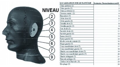 Cone beam pratique en odontostomatologie – Partie II - Principe, technique, qualité d’image, artéfacts, types d’appareil, indications