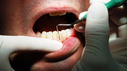 La terapia periodontal puede reducir los gastos médicos
