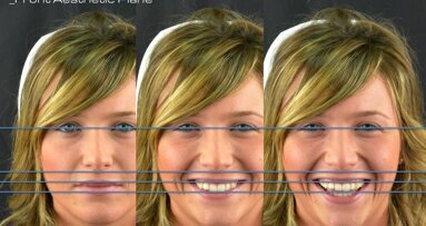 El diseñador digital de sonrisas