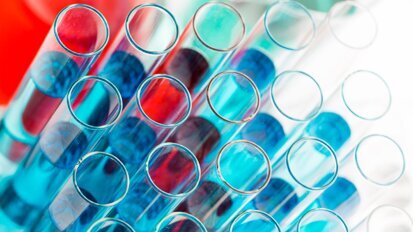 Badaczki UJ opracowały nowy sposób pozyskiwania komórek tkanki kostnej do bezpiecznych przeszczepów