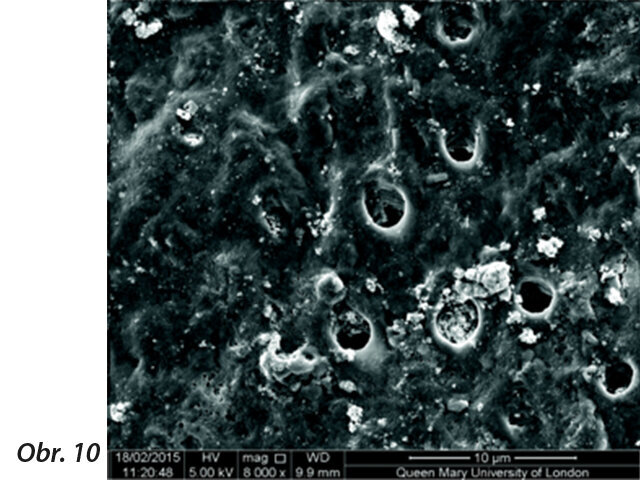Obr. 10: Kanálky zůstaly uzavřené i po vystavení kyselinám (výzkum na Queen Mary University of London).