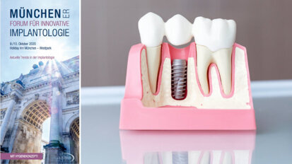 Implantologietrends im Oktober in München Implantologietrends im Oktober in München
