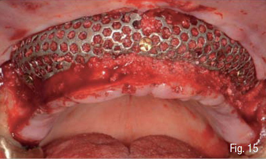 Fig. 15